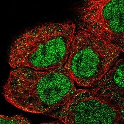 RNF12 Antibody, Novus Biologicals 0.1mL; Unlabeled:Antibodies, Polyclonal