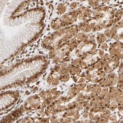 RNF122 Antibody, Novus Biologicals 0.1mL; Unlabeled:Antibodies, Polyclonal