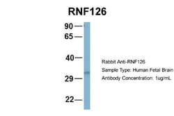 RNF126 Antibody, Novus Biologicals 0.05mg; Unlabeled:Antibodies, Polyclonal