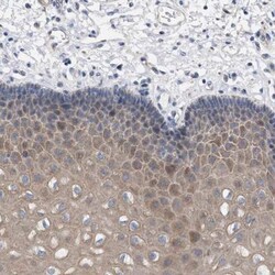 RNF135 Antibody, Novus Biologicals 25 &mu;L; Unlabeled:Antibodies, Polyclonal
