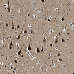 RNF141 Antibody, Novus Biologicals:Antibodies:Primary Antibodies