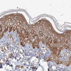 RNF145 Antibody, Novus Biologicals:Antibodies:Primary Antibodies