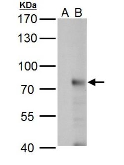 RNF168 Antibody, Novus Biologicals 0.1mL; Unlabeled:Antibodies, Polyclonal