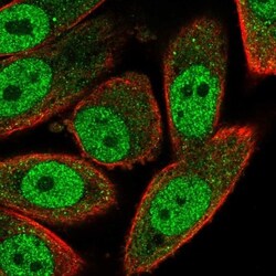 RNF181 Antibody, Novus Biologicals:Antibodies:Primary Antibodies