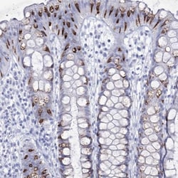 RNF186 Antibody, Novus Biologicals:Antibodies:Primary Antibodies