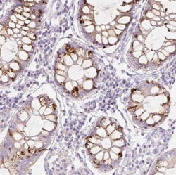 RNF186 Antibody, Novus Biologicals 0.1mL; Unlabeled:Antibodies, Polyclonal