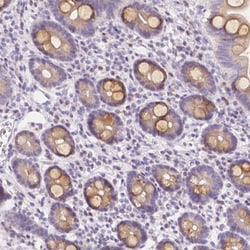 RNF186 Antibody, Novus Biologicals 0.1mL; Unlabeled:Antibodies, Polyclonal