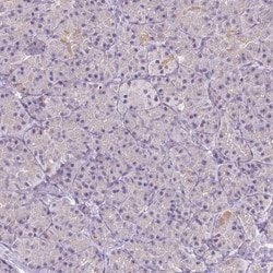 RNF186 Antibody, Novus Biologicals 0.1mL; Unlabeled:Antibodies, Polyclonal