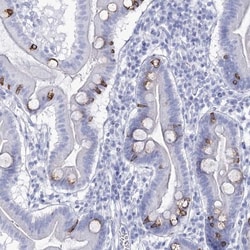 RNF186 Antibody, Novus Biologicals:Antibodies:Primary Antibodies