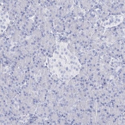 RNF186 Antibody, Novus Biologicals:Antibodies:Primary Antibodies