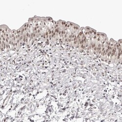 RNF2 Antibody, Novus Biologicals 0.1mL; Unlabeled:Antibodies, Polyclonal