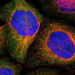 RNF213 Antibody, Novus Biologicals:Antibodies:Primary Antibodies