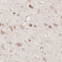 RNF213 Antibody, Novus Biologicals:Antibodies:Primary Antibodies