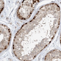 RNF219 Antibody, Novus Biologicals:Antibodies:Primary Antibodies