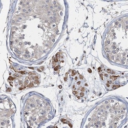 RNF25 Antibody, Novus Biologicals:Antibodies:Primary Antibodies