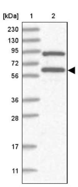 RNF25 Antibody, Novus Biologicals 0.1mL; Unlabeled:Antibodies, Polyclonal