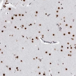 RNF26 Antibody, Novus Biologicals 25 &mu;L; Unlabeled:Antibodies, Polyclonal