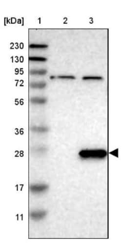 RNF41 Antibody, Novus Biologicals:Antibodies:Primary Antibodies