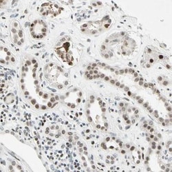 RNF43 Antibody, Novus Biologicals 0.1mL; Unlabeled:Antibodies, Polyclonal