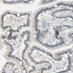 RNF43 Antibody, Novus Biologicals 0.1mL; Unlabeled:Antibodies, Polyclonal