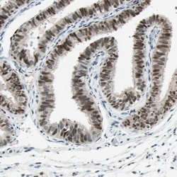 RNF43 Antibody, Novus Biologicals 0.1mL; Unlabeled:Antibodies, Polyclonal