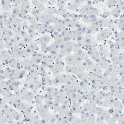 RNF43 Antibody, Novus Biologicals 0.1mL; Unlabeled:Antibodies, Polyclonal