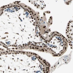 RNF43 Antibody, Novus Biologicals 0.1mL; Unlabeled:Antibodies, Polyclonal
