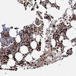 RNF6 Antibody, Novus Biologicals 0.1mL; Unlabeled:Antibodies, Polyclonal