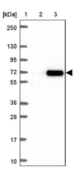 RNF6 Antibody, Novus Biologicals 0.1mL; Unlabeled:Antibodies, Polyclonal