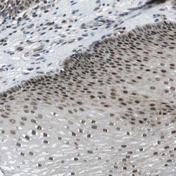 RNF70 Antibody, Novus Biologicals 25 &mu;L; Unlabeled:Antibodies, Polyclonal