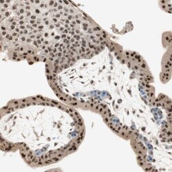 RNGTT Antibody, Novus Biologicals 0.1mL; Unlabeled:Antibodies, Polyclonal