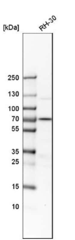 RNGTT Antibody, Novus Biologicals 0.1mL; Unlabeled:Antibodies, Polyclonal