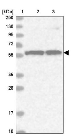 RNMT Antibody, Novus Biologicals 0.1mL; Unlabeled:Antibodies, Polyclonal