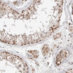 RNMTL1 Antibody, Novus Biologicals:Antibodies:Primary Antibodies