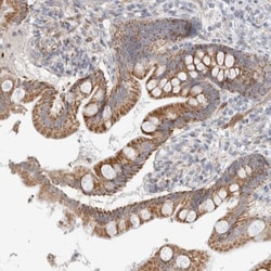 RNMTL1 Antibody, Novus Biologicals 25 &mu;L | Buy Online | Novus Biologicals | Fisher Scientific