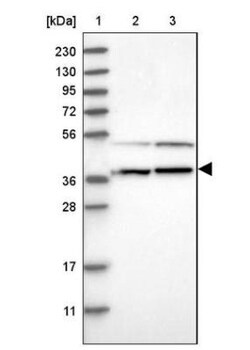 RNMTL1 Antibody, Novus Biologicals:Antibodies:Primary Antibodies