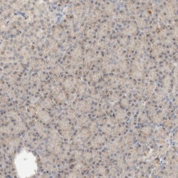 RNMTL1 Antibody, Novus Biologicals:Antibodies:Primary Antibodies