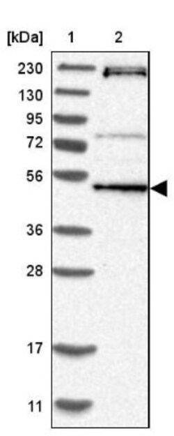 RNMTL1 Antibody, Novus Biologicals 25 &mu;L | Buy Online | Novus Biologicals | Fisher Scientific