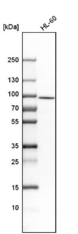 RNase L Antibody, Novus Biologicals:Antibodies:Primary Antibodies
