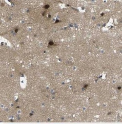 ROBO2 Antibody, Novus Biologicals 0.1mL; Unlabeled:Antibodies, Polyclonal