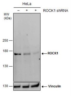 ROCK1 Antibody (261), Novus Biologicals 0.1mL; Unlabeled:Antibodies, Monoclonal