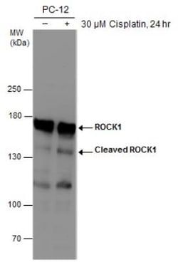 ROCK1 Antibody (261), Novus Biologicals 0.1mL; Unlabeled:Antibodies, Monoclonal