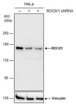 ROCK1 Antibody (464), Novus Biologicals 0.1mL; Unlabeled:Antibodies, Monoclonal