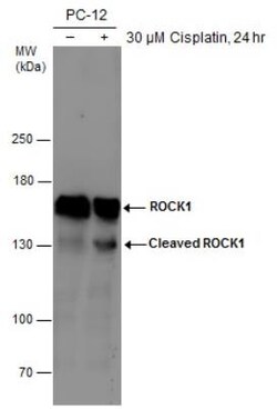 ROCK1 Antibody (464), Novus Biologicals 0.1mL; Unlabeled:Antibodies, Monoclonal
