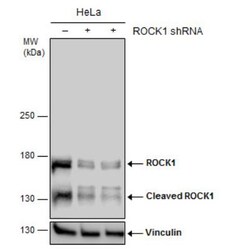 ROCK1 Antibody, Novus Biologicals 0.1mL; Unlabeled:Antikroppar