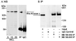 ROCK2 Antibody, Novus Biologicals 0.1mg; Unlabeled:Antibodies, Polyclonal