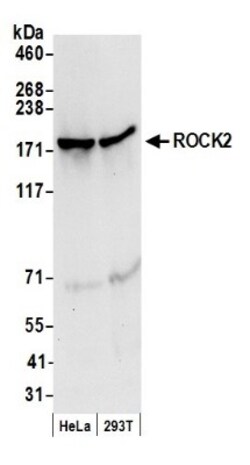 ROCK2 Antibody, Novus Biologicals 0.1mg; Unlabeled:Antibodies, Polyclonal