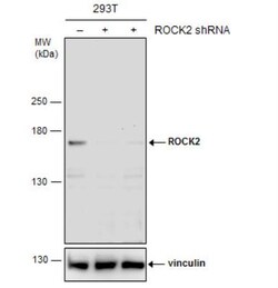 ROCK2 Antibody, Novus Biologicals 0.1mL; Unlabeled:Antibodies, Polyclonal