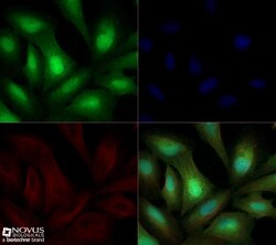 ROR gamma/RORC/NR1F3 Antibody - BSA Free, Novus Biologicals:Antibodies:Primary