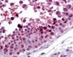 ROR gamma/RORC/NR1F3 Antibody - BSA Free, Novus Biologicals:Antibodies:Primary